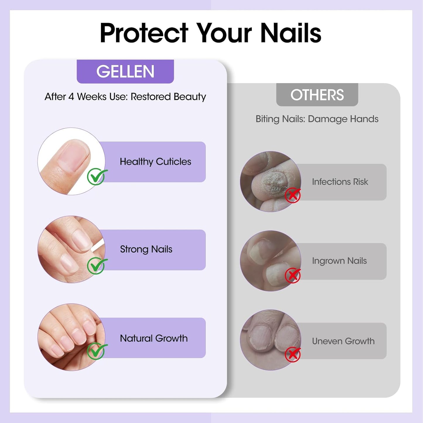 Gellen Nail Biting Treatment for Kids & Adults, Roll-On Stop Thumb Sucking Deterrent, 10ml Nail Biting Prevention, Quick Dry & Water-Resistant No Bite Nail Polish, Nail Care Solution