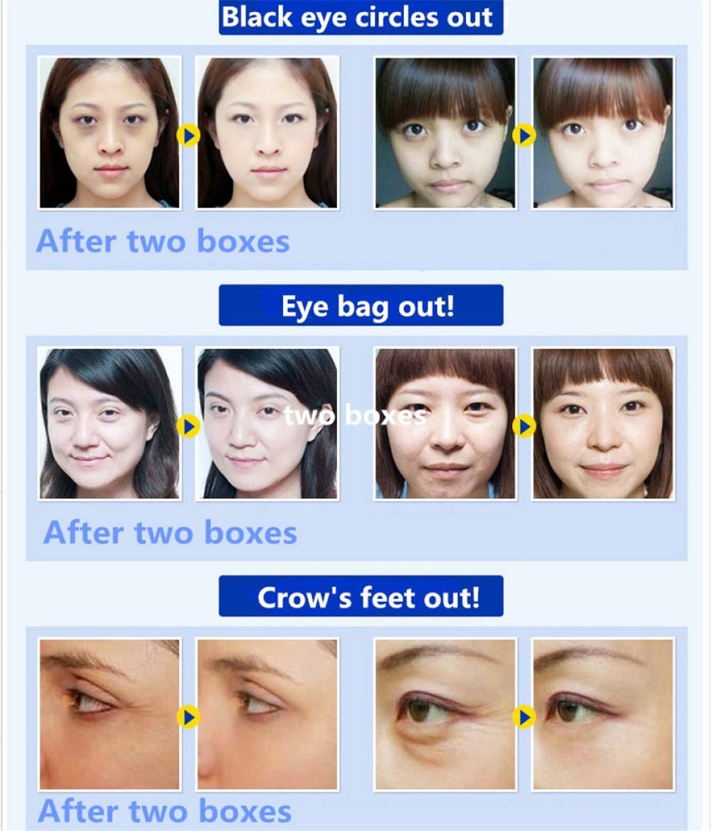 Adofect 30 Pairs Pink Collagen Under Eye Mask Anti-Aging Hyaluronic Acid Eye Patches for Moisturizing & Reducing Dark Circles, Luxury Gift for Women and Men, Pink