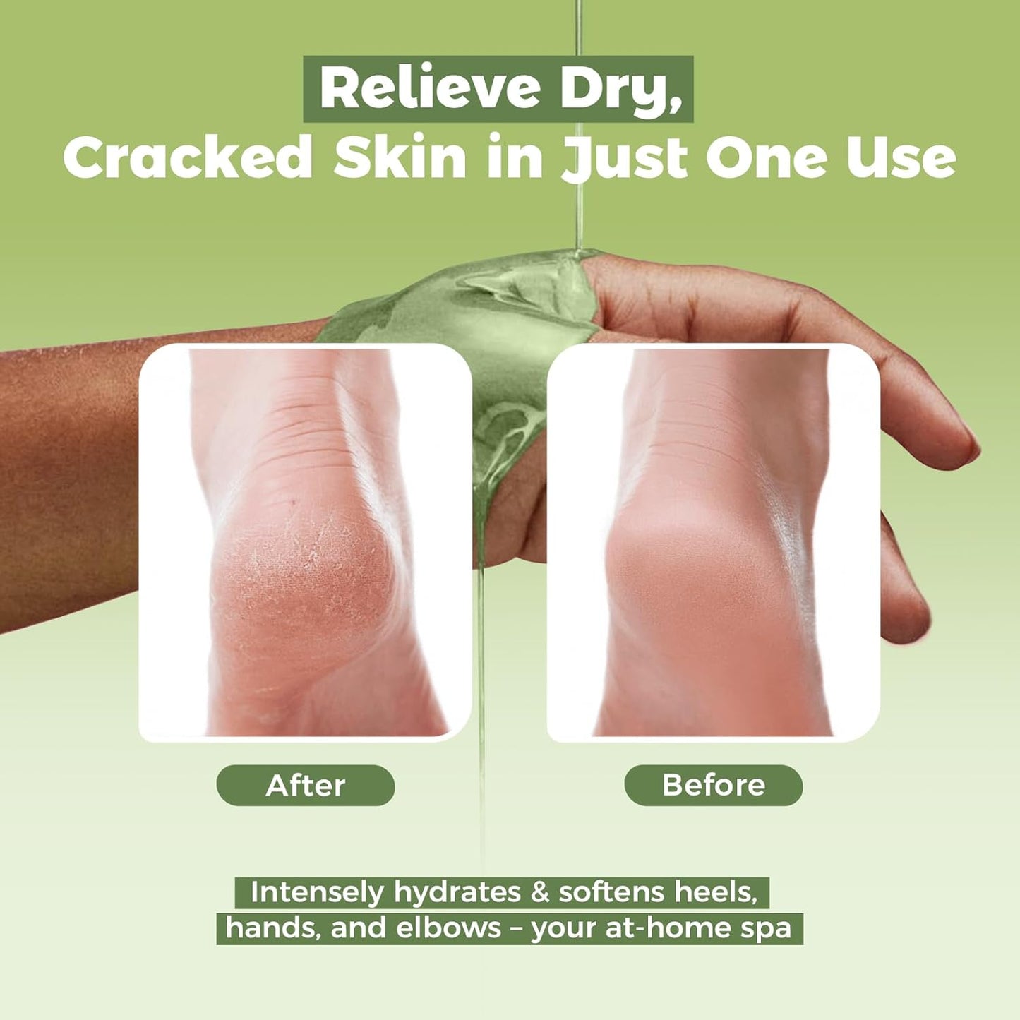 Paraffin Wax Refills 10 Packs for Paraffin Wax Bath Machine - for Dry Cracked Skin on Hands, Feet, Elbows - Moisturizing Hydration to Relieve Stiff Muscles & Joints (Aloe vera)