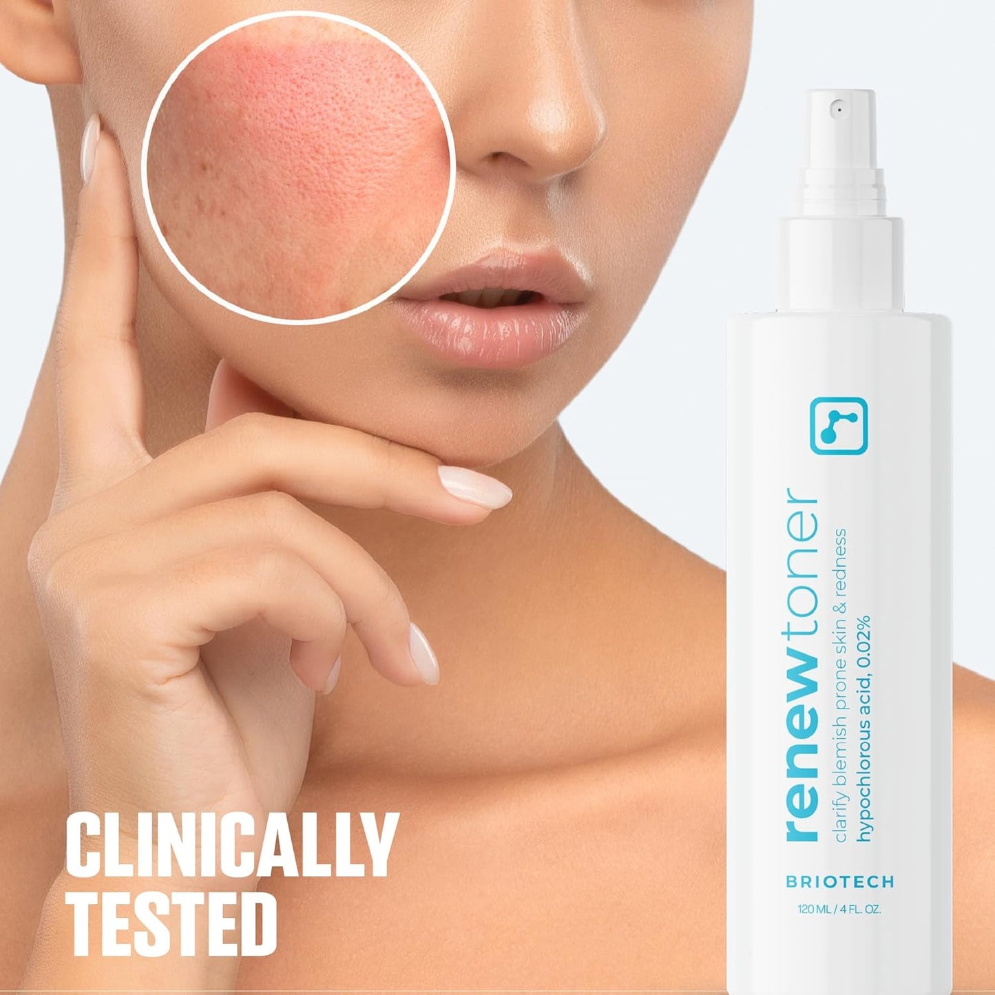 BRIOTECH Renew Toner, Hypochlorous Acid Spray, Minimize Appearance of Blemishes, Soothing Facial Mist for Sensitive Skin, Calm Redness & Bumps, Vegan, 4 fl oz (4 Pack)