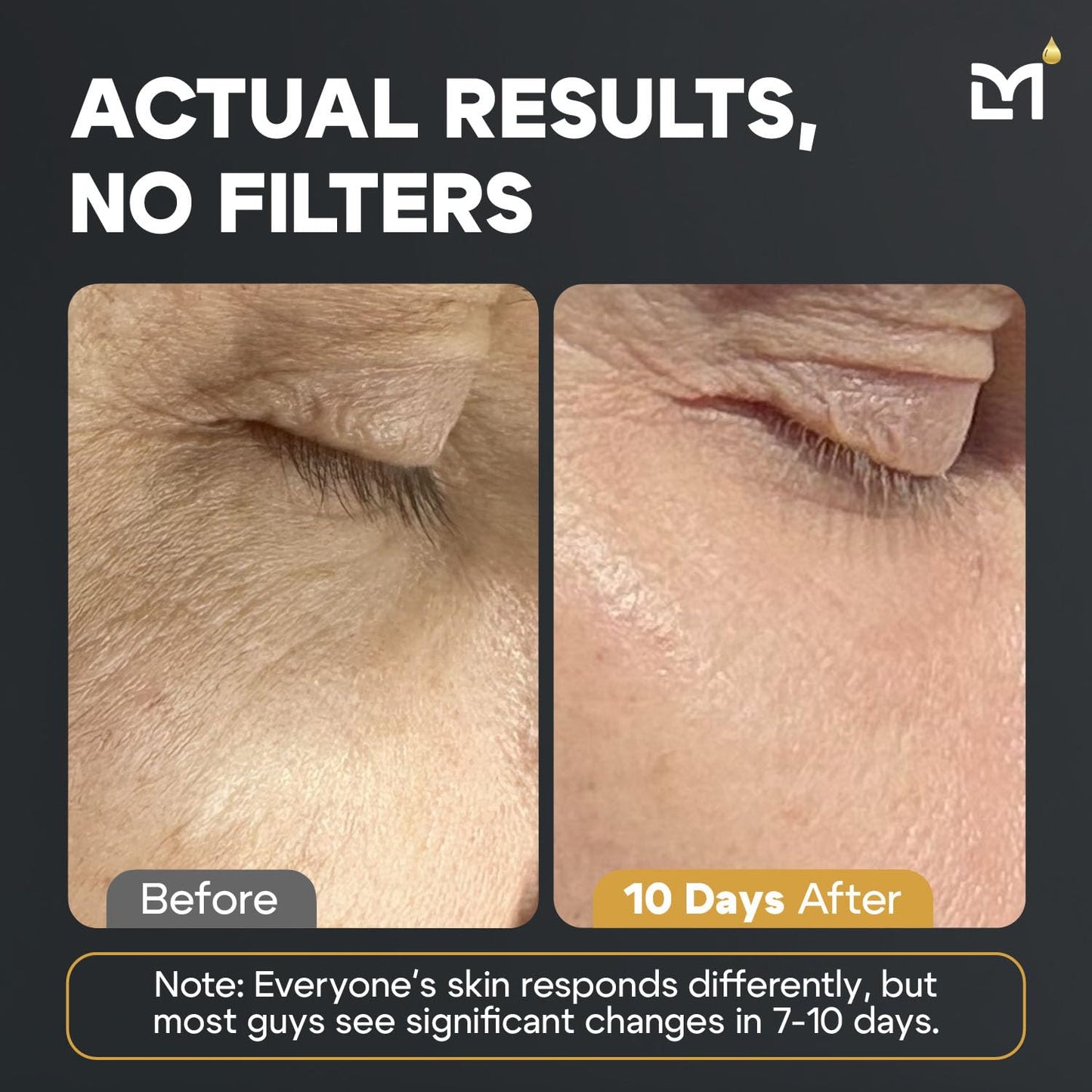 Titan Golden Anti-Aging Mens Skin Care Kit – Wash, Face Serum, Mens Face Moisturizer – Men, Skin Care Set – Dark Spots, Wrinkles, Fine Lines – Vitamin C, Peptides, Niacinamide, HA – Unscented