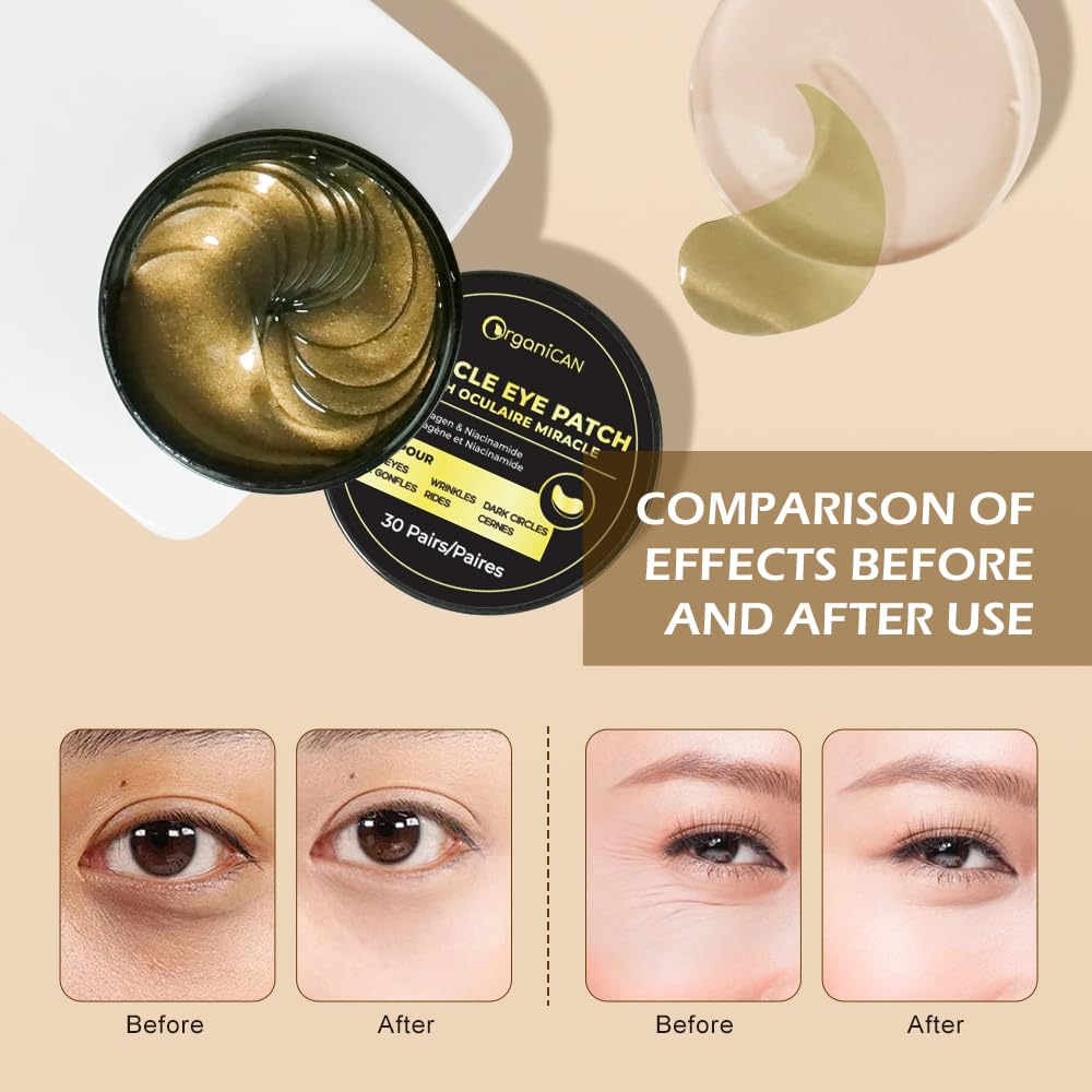 Under Eye Mask with Caffeine, Collagen, Niacinamide (60 Patches), Eye Pads for Puffy, Tired Eyes, Dark Circles