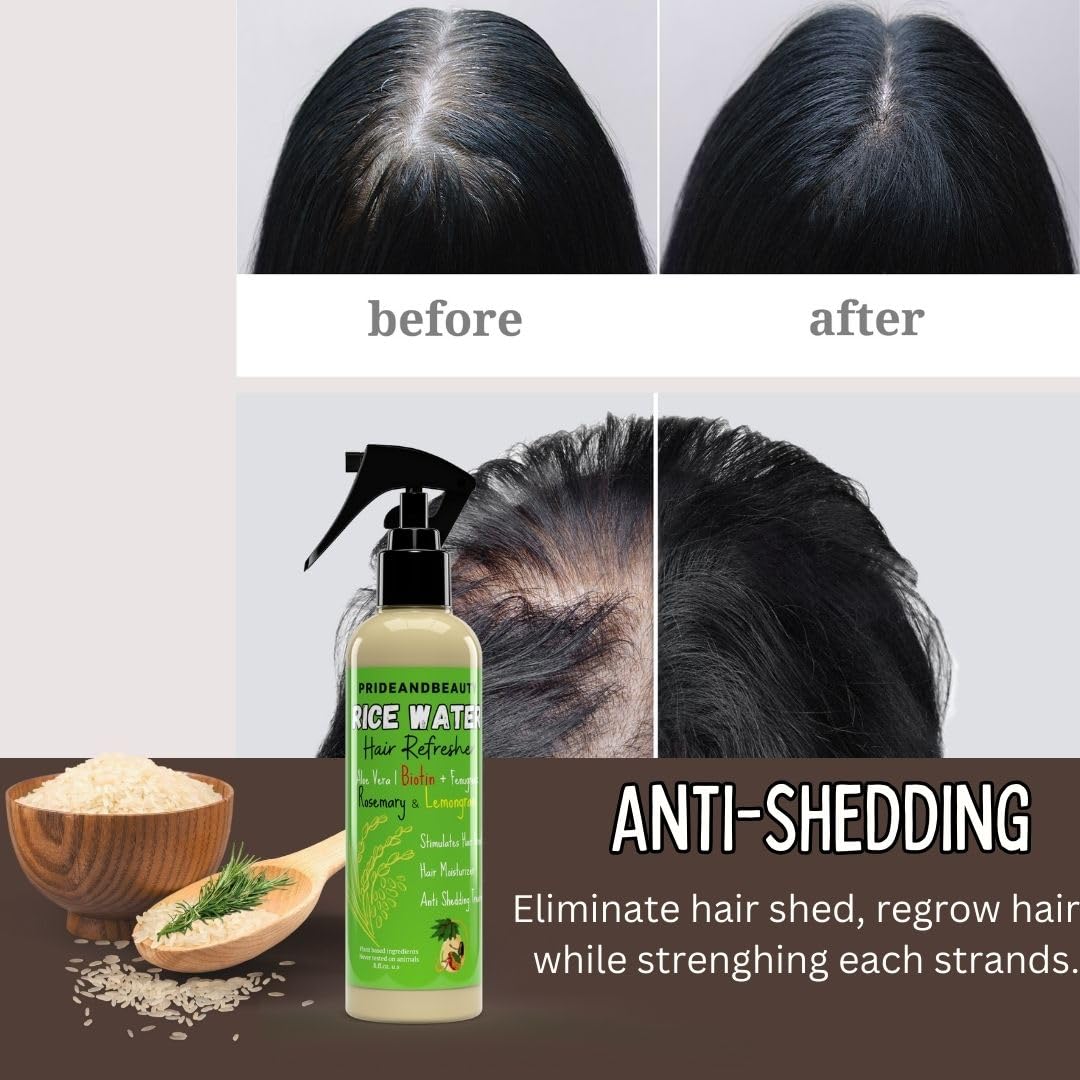 NEW Fermented Rice Water for Hair Growth - Infused with Rosemary, Biotin, Caffeine, Keratin Vegan Non-Greasy Spray Naturally Thicker, Longer, Softer Men & Women (12 OUNCES, Rosemary Lemongrass)