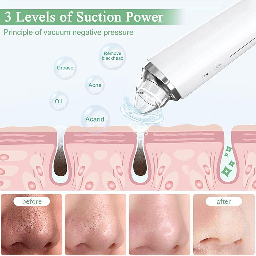 Blackhead Remover Pore Vacuum, 【[FDA Certification] 】 WiFi Visible Facial Pore Cleanser with HD Camera Pimple Acne Comedone Extractor Kit with 6 Suction Heads Electric Blackhead Suction Tool