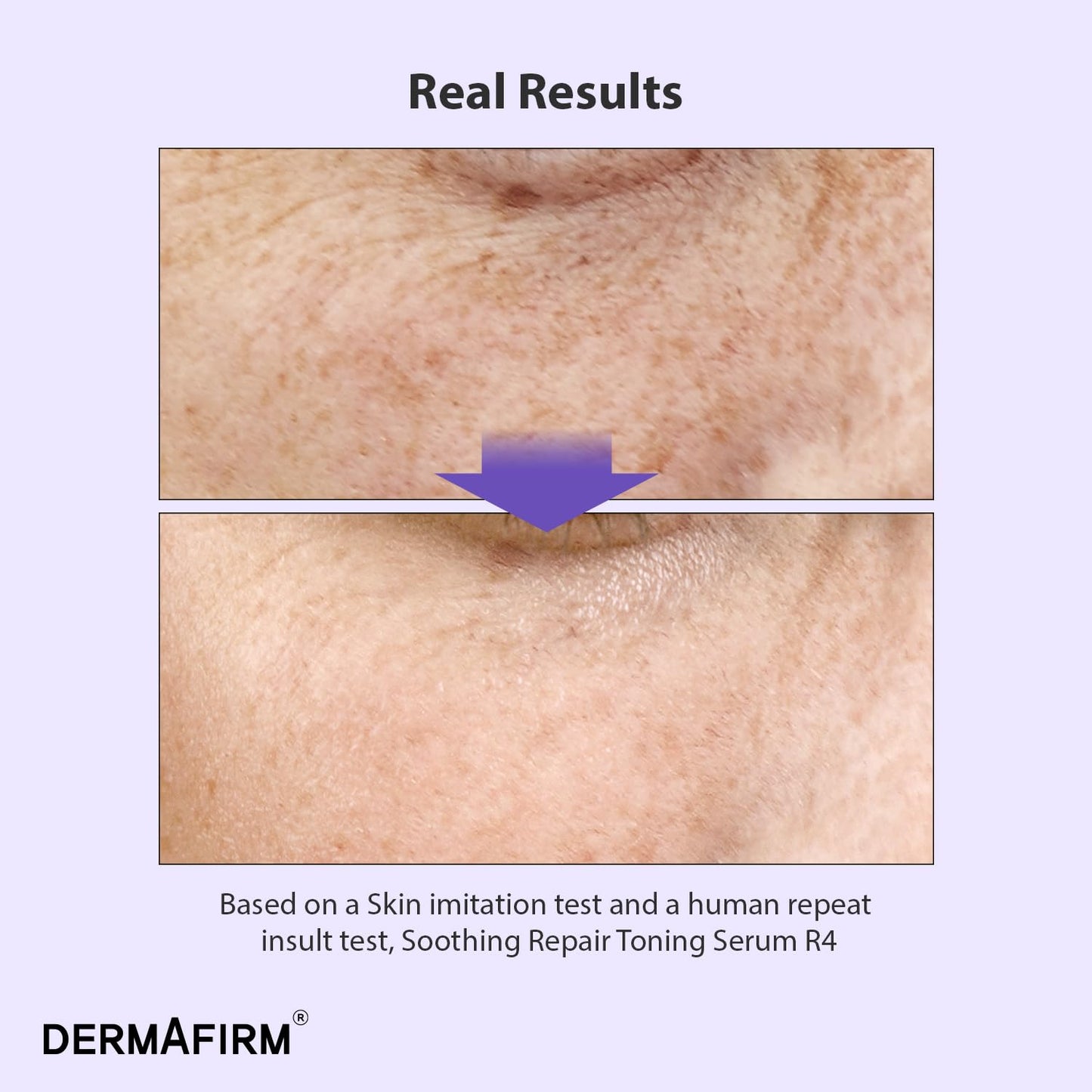 [Refill] DERMAFIRM Soothing Repair Toning Serum R4 - Korean Bakuchiol Retinol Niacinamide & Peptide Face Serum for Wrinkles - Calming, Moisturizing & Correcting- Paraben-Free, Cruelty-Free, 1.01 fl oz