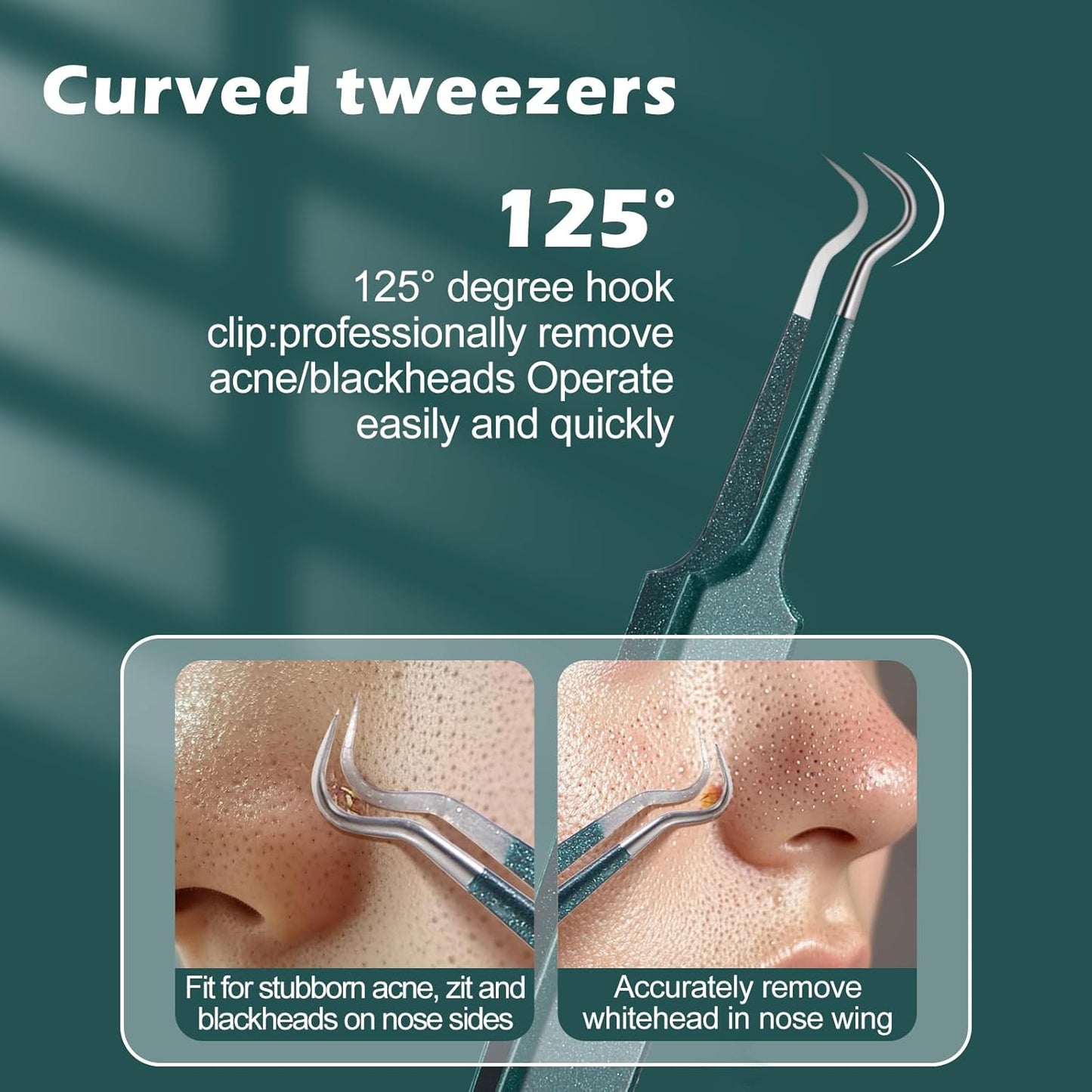 WSYUB Upgrade Professional Facial Blackhead Remover Tweezers, Ingrown Hair Tweezers,Extractor Acne Removal, Pimple Popper Tool,Green
