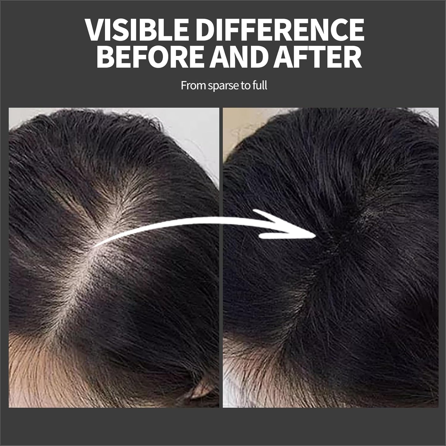 Hair Building Fibers - Instant Volume for Thinning Hair, Natural Appearance with Electrostatic Adsorption,Plant-Based, All-Day Hold, 25G Medium brown