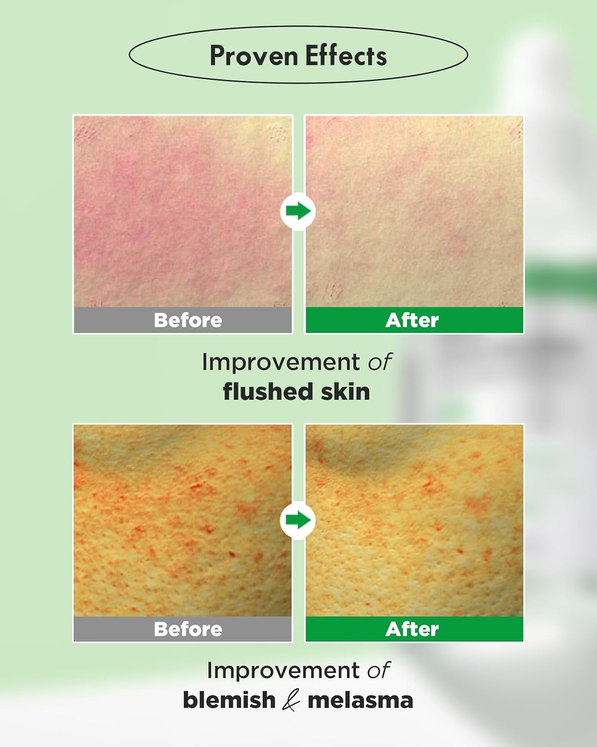 WELLAGE Real Cica Calming Trouble Ampoule - Korean Skincare Soothing Serum, Madecassoside Centella Asiatica Panthenol Niacinamide, Relief Redness, Sebum Control, Improves Blemishes, 1.69 fl.oz.