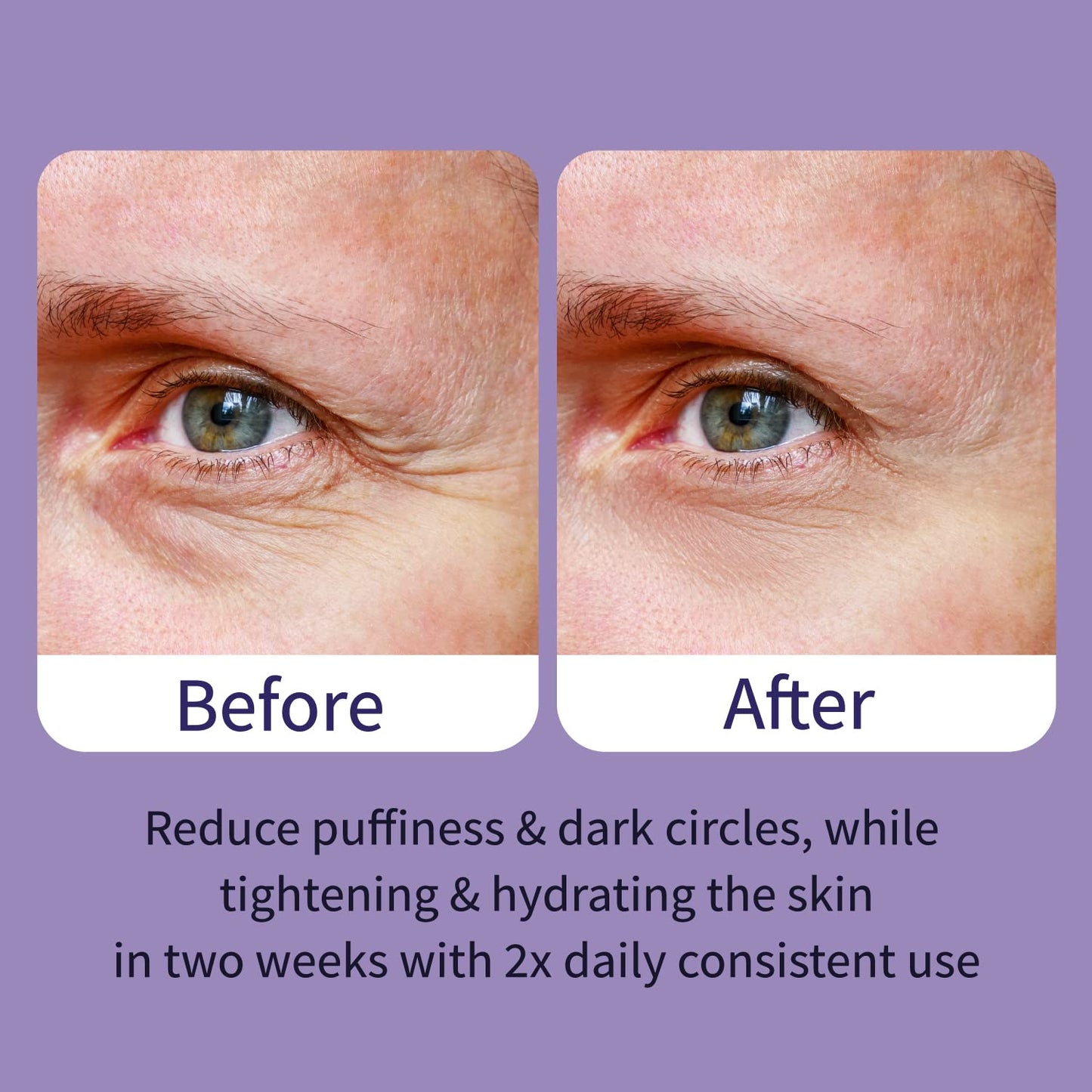 Ebanel Peptides Eye Serum, Dark Circles Under Eye Treatment for Women and Men, Under Eye Bags Puffiness Remover, Eye Lifting and Firming Serum with Wine Extract, Lavender Extract, Olive Leaf Extract