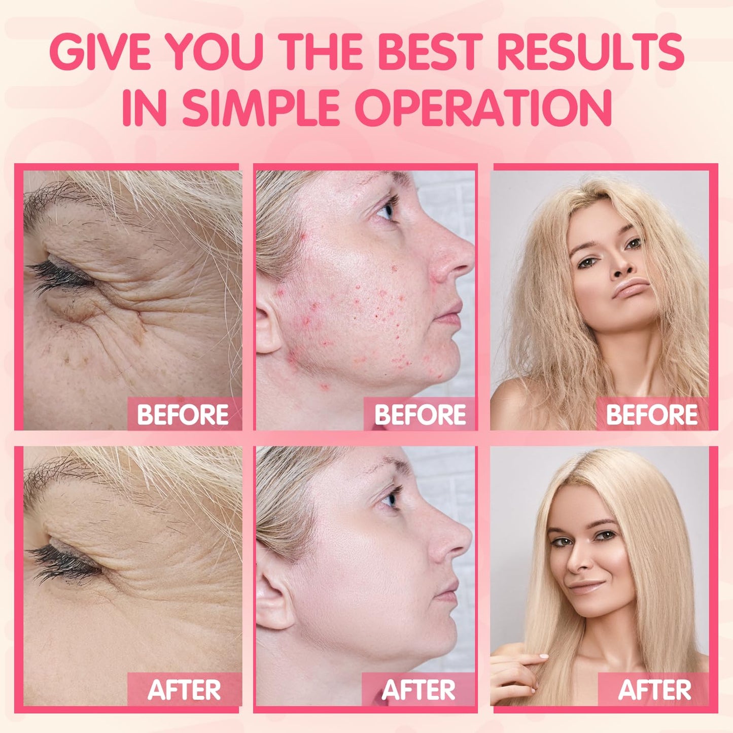 TUMAKOU Portable High Frequency Facial Machine - Orange High Frequency Face Skin Wand Device