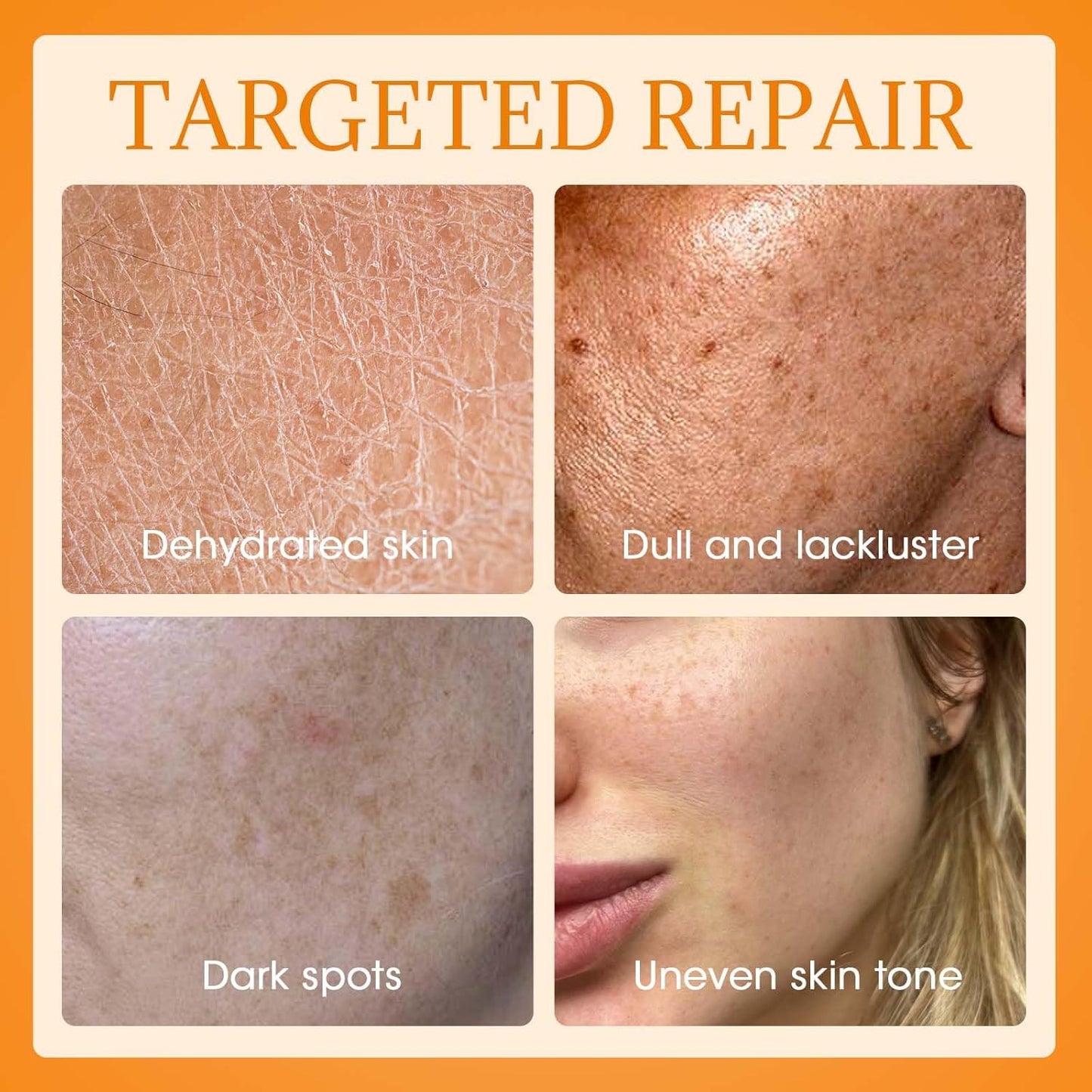 MQ Vitamin C Cream Visibly Brightening Body Lotion | Vitamin C Moisturizer Care Body Cream, Revitalizes Dull-Looking Skin, Promotes A Glowing Complexion