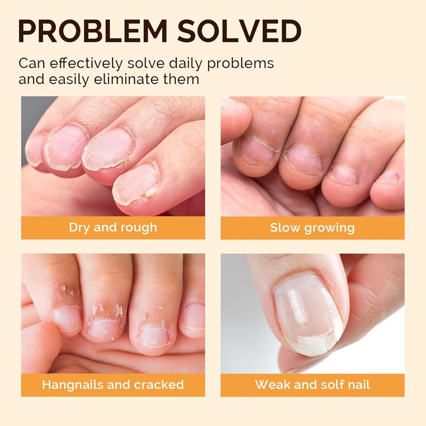 MelodySusie 12Pcs Cuticle Oil Pen Set,Nail Moisturizing Cuticle Oil Enriched with Vitamin E,Softens and Repairs cuticles,Nail Strengthener,Protects Damaged Skin,Thin Nails