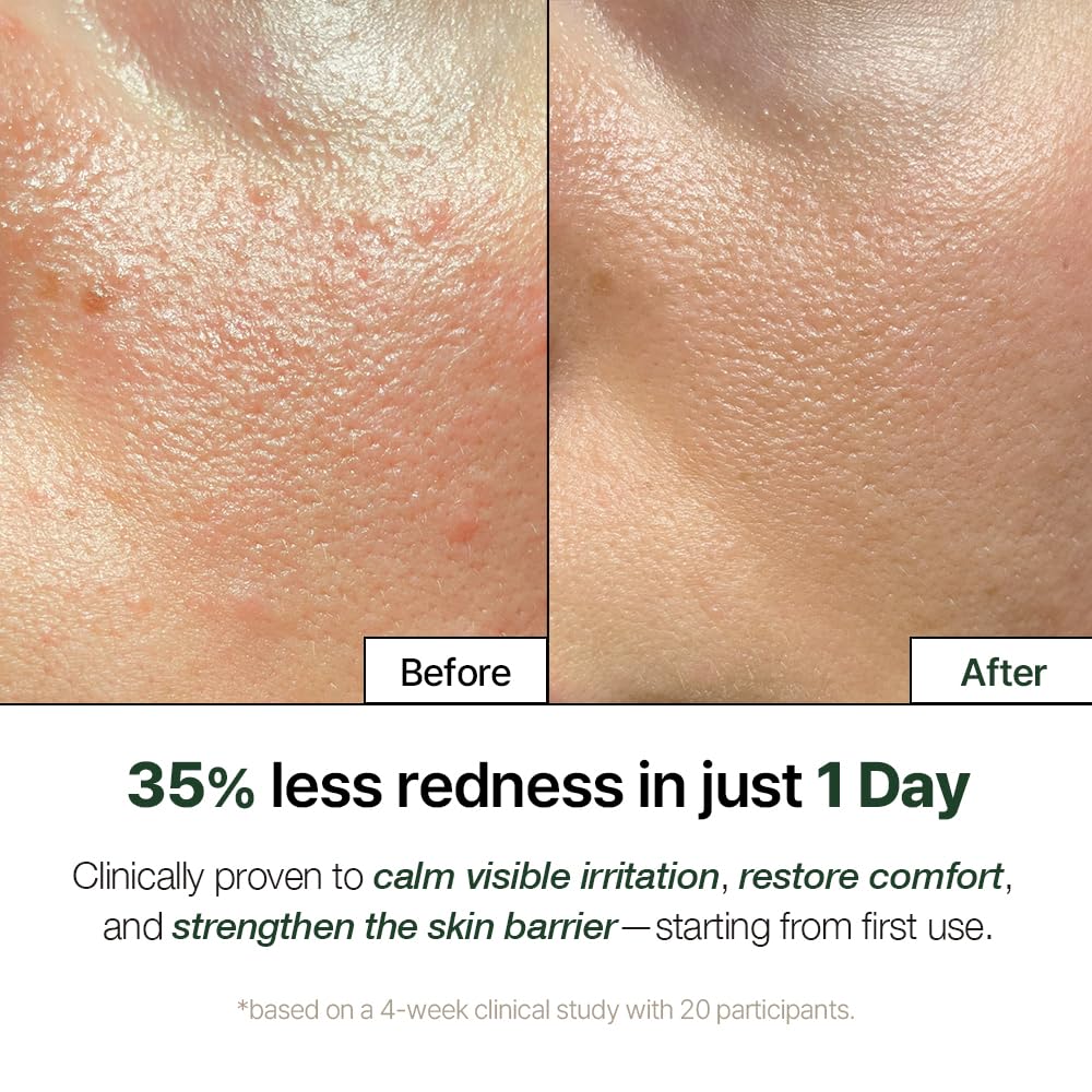 NDP Cica Cream - Gel Face Moisturizer for Sunburn Relief, lightweight Korean Moisturizer for Sensitive Skin, Centella Asiatica, Hydrating, Calming, Soothing (1.7 Fl oz / 50ml)