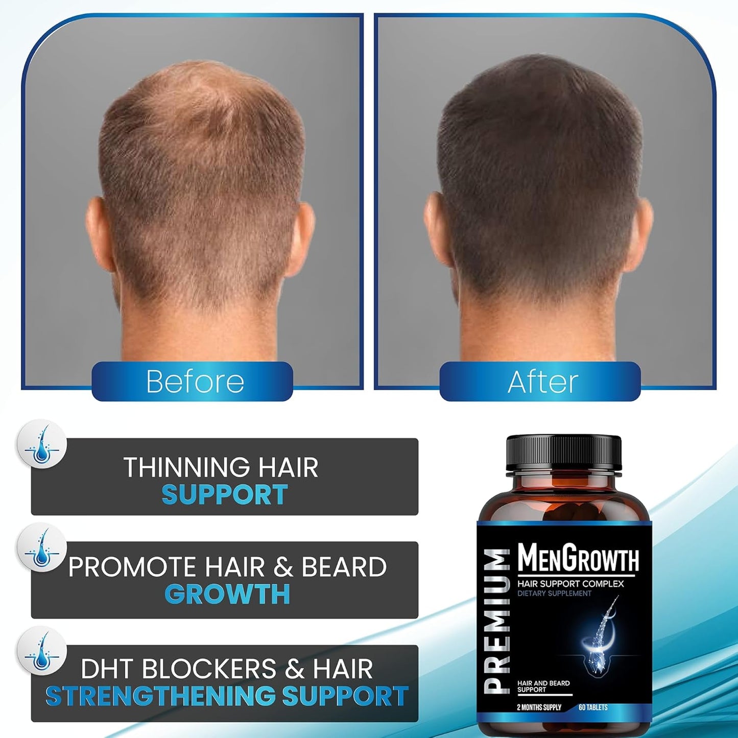 Mens Hair Growth-Hair Vitamins For Men. Anti Hair Loss Supplement, Regrow Hair & Beard Growth Pills With DHT Blocker For Thinning Hair & Hair Thickening With Biotin & Saw Palmetto.Thicker Fuller Hair