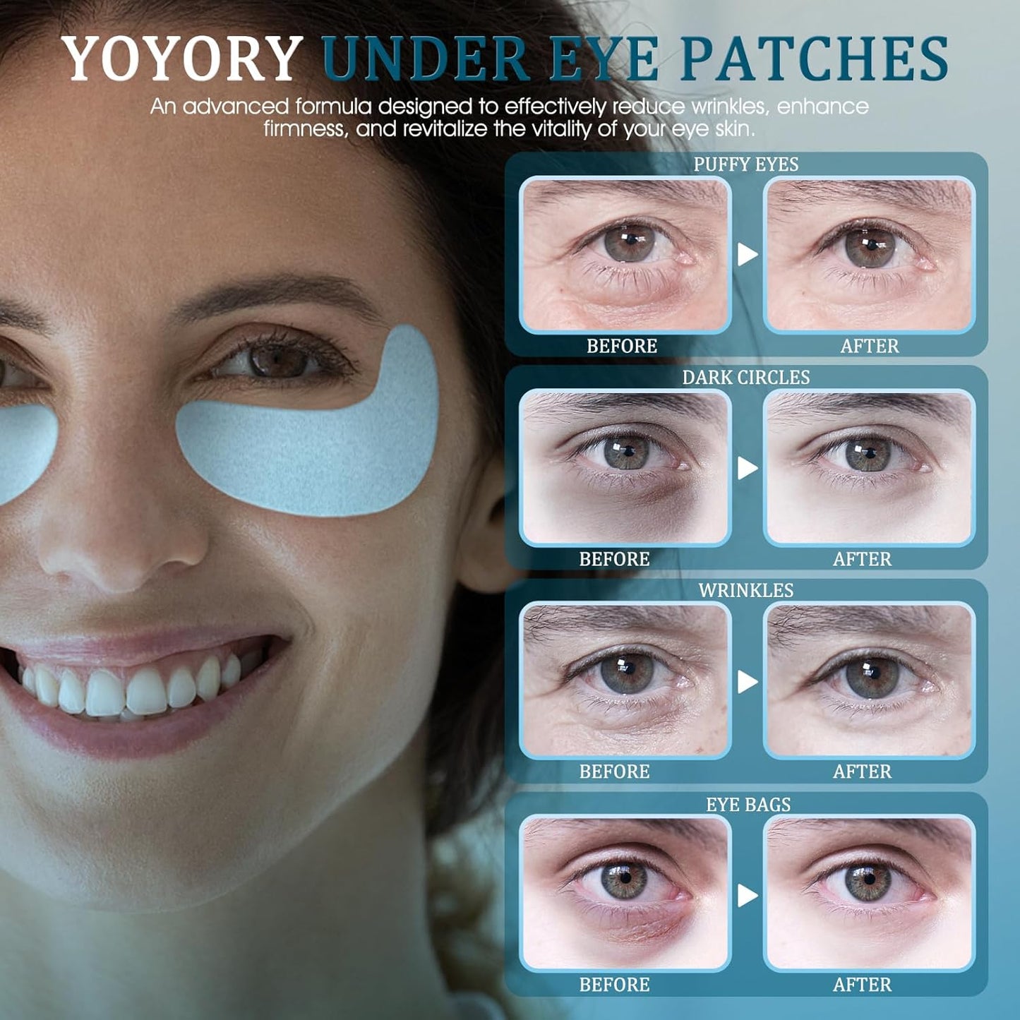 Under Eye Patches Masks - for Dark Circles, Wrinkles, Puffy Eyes, Fine Lines, Eye Bags Treatment with Hyaluronic Acid and Collagen, Hydrating and Moisturizing (30 Pcs)