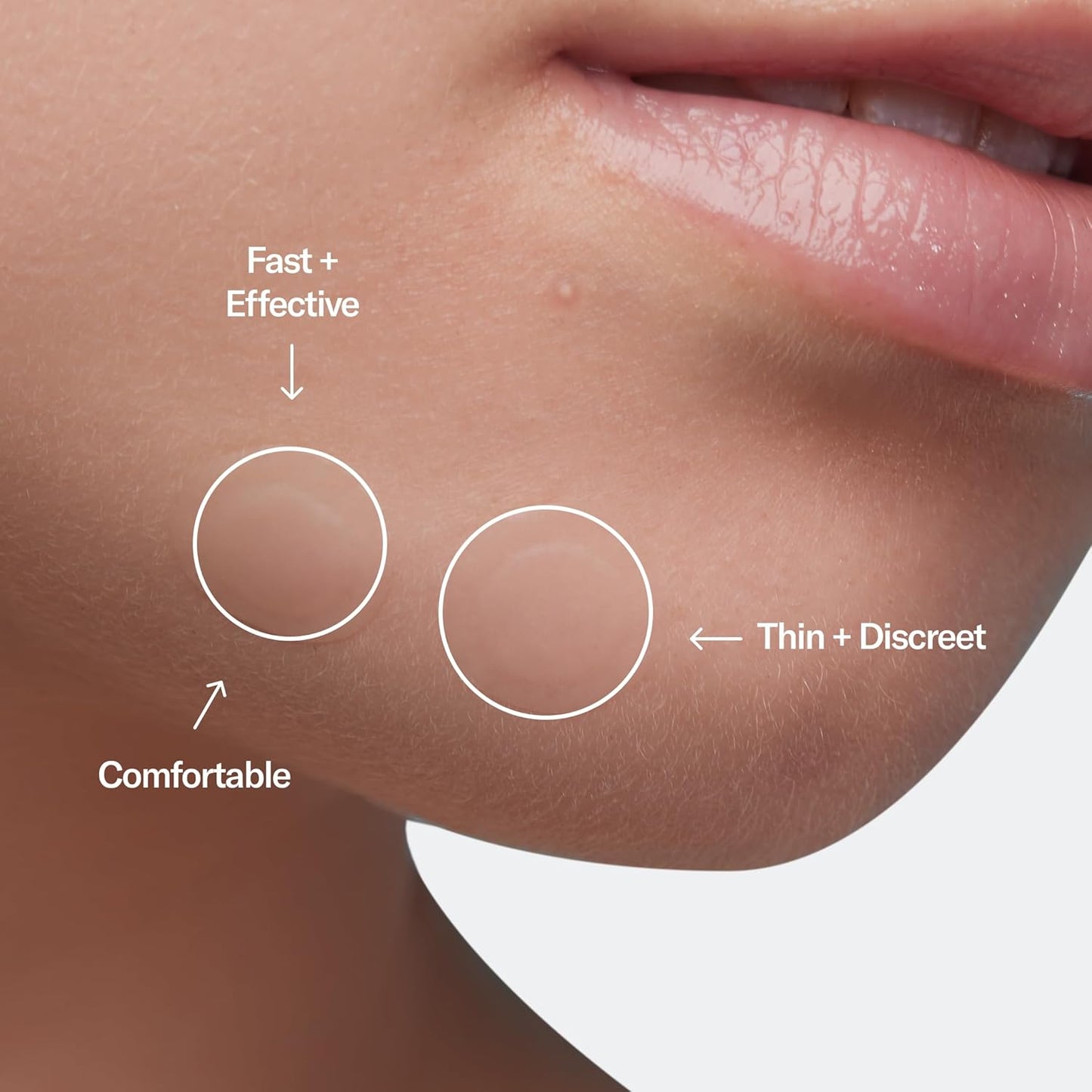 Geologie Zit Zapper Pimple Patches - 2 Pack (40 Ct.) - Rapid Relief Pimple Patches