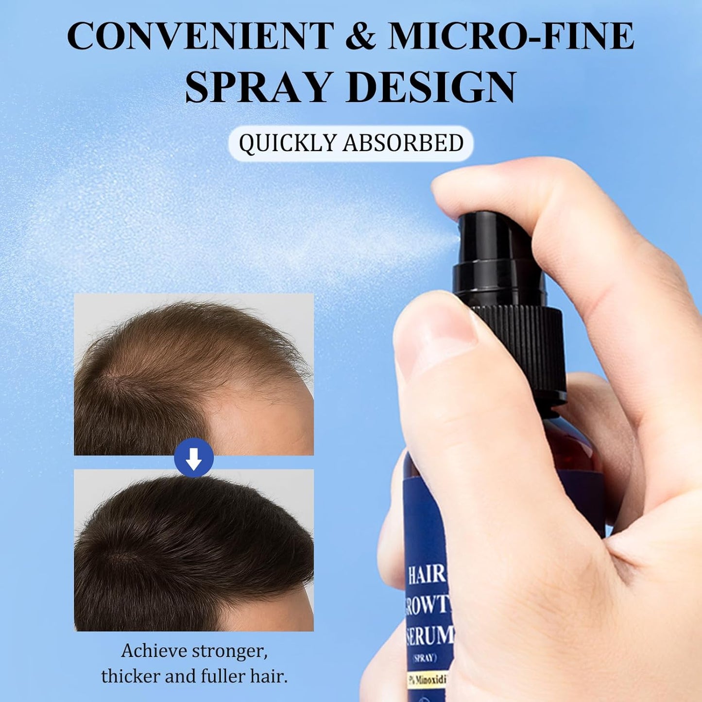 5% Minoxidil Hair Growth Spray - Minoxidil for Men and Women Hair Growth, Hair Regrowth Treatment for Stronger Thicker Hair (60ml)