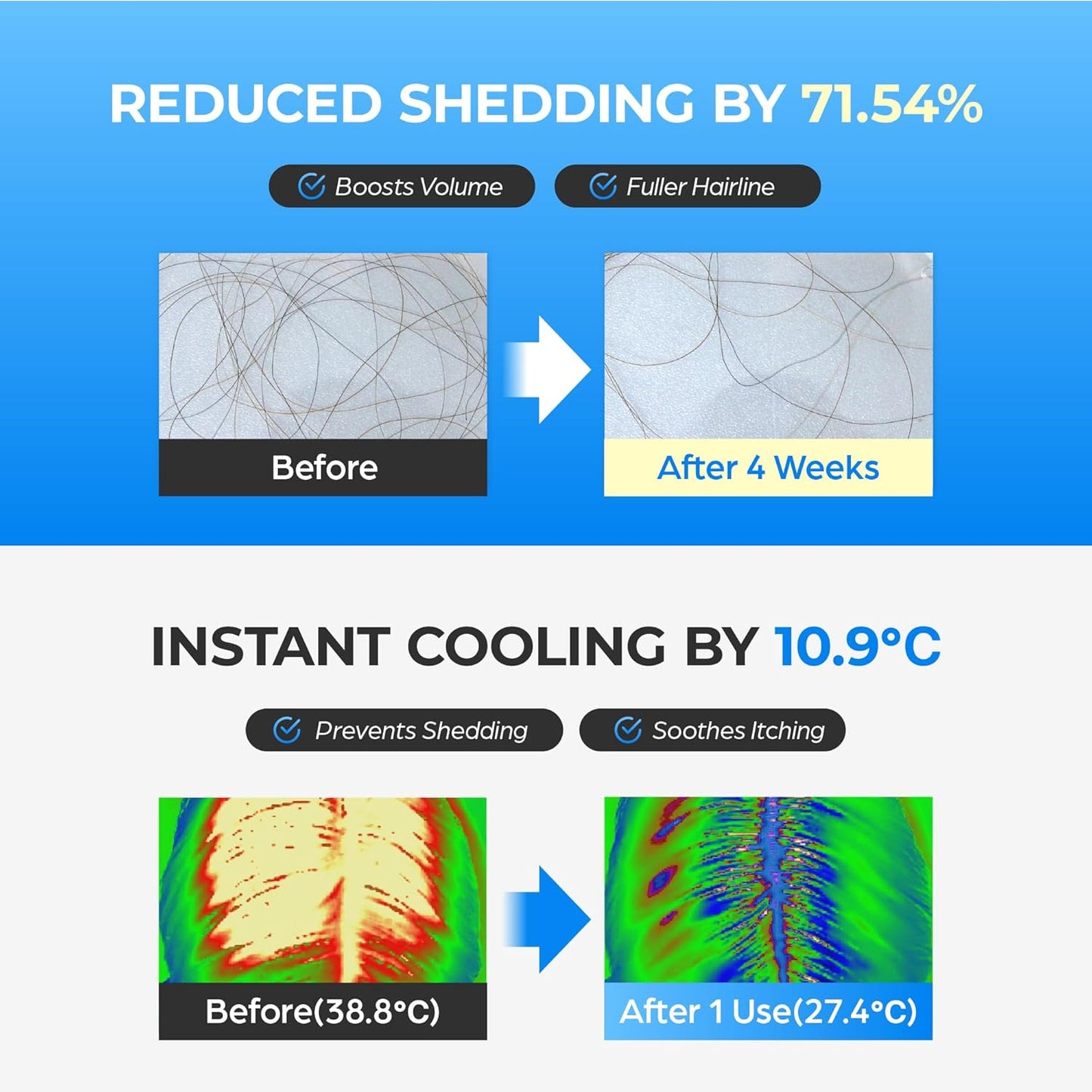 Scalpy Hair Growth Serum for Men & Women for Hair Loss & Thinning | Scalp Treatment with Salicylic Acid, Menthol, Dexpanthenol | Non-Greasy, Lightweight | Exfoliates Dandruff & Soothes Itch
