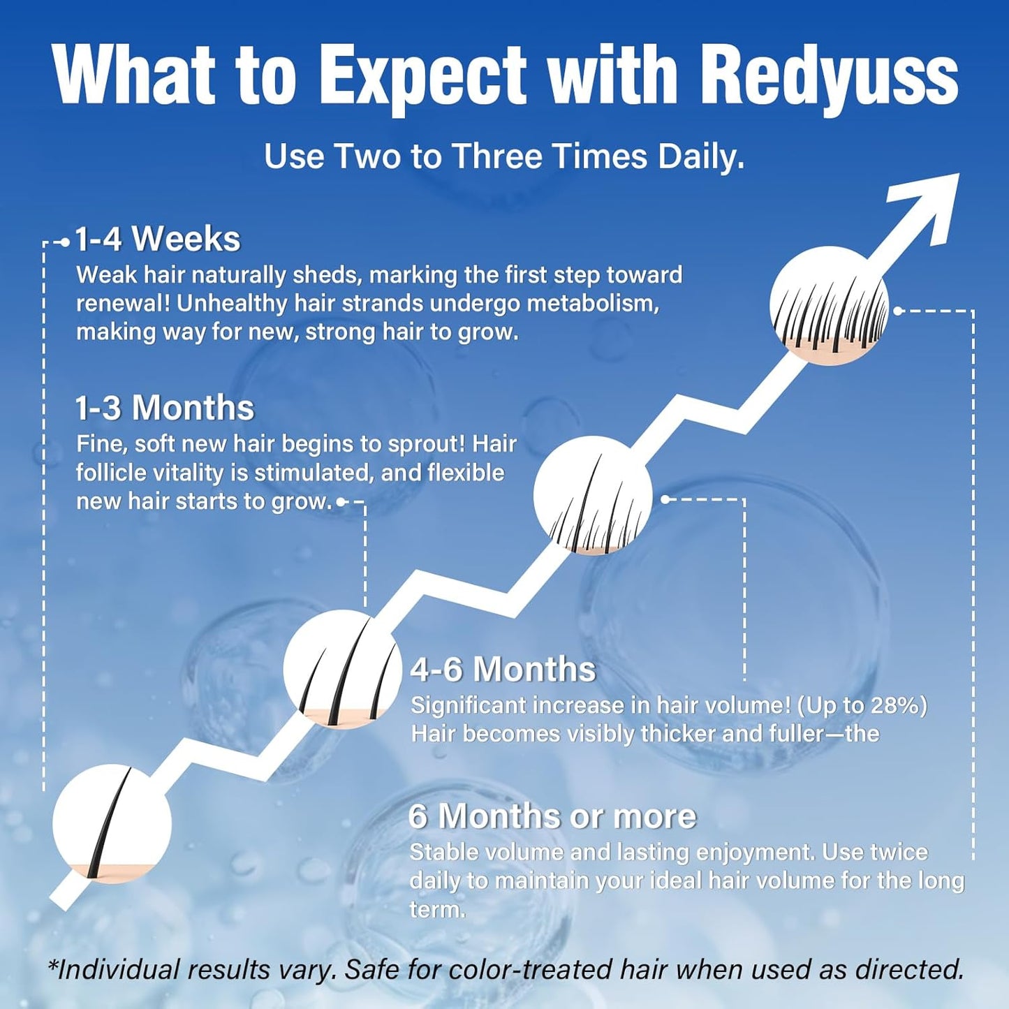 5% Minoxidil for Men and Women Hair Growth Spray Serum Minoxidil Biotin for Hair Beard Growth Prevent Hair Loss for Thicker Longer Fuller Healthier Hair 3 Bottles of 2oz