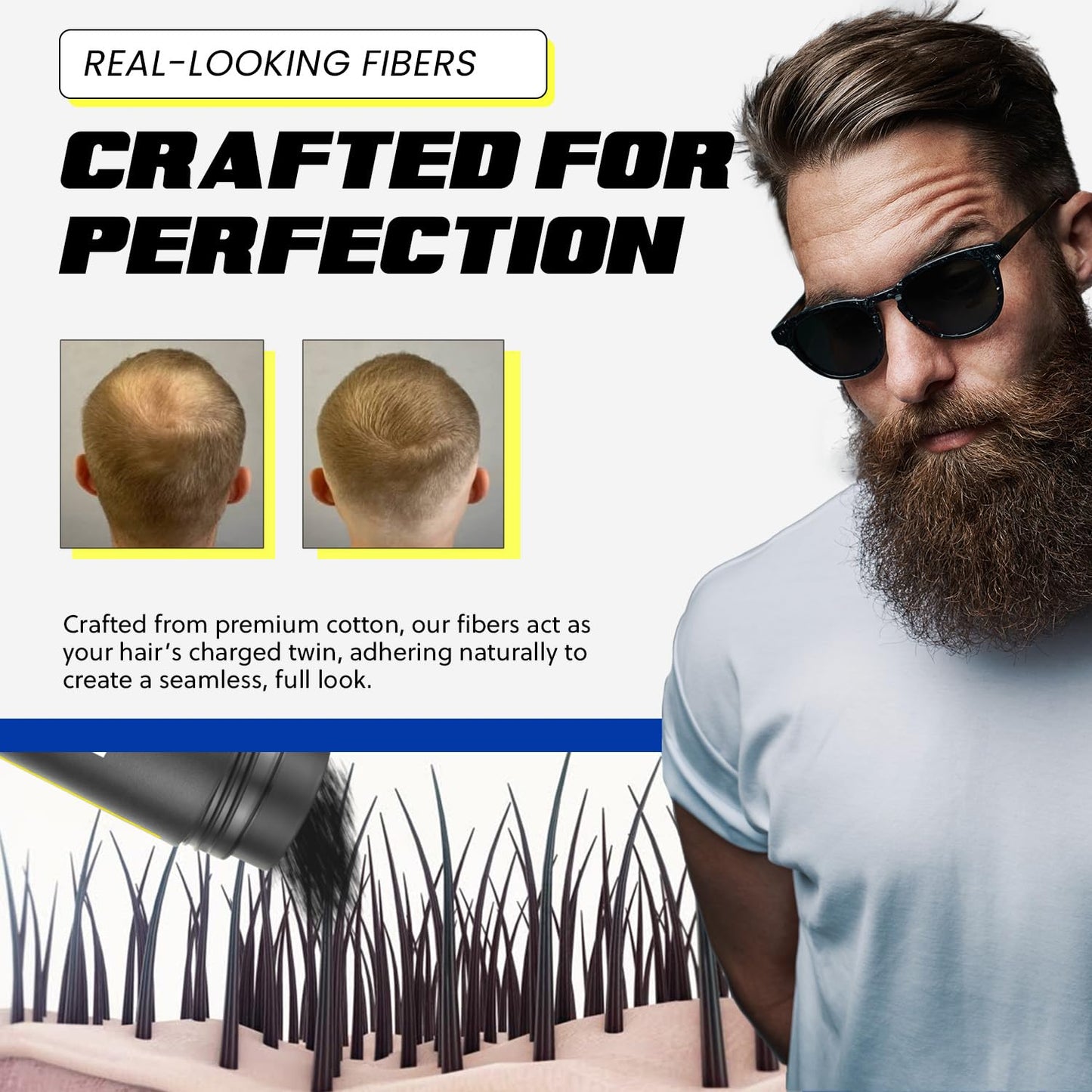 PrimeLook Hair Building Fibers, Luxurious Building Fibers for Thinning Hair, Superior Formula for Men & Women, Instant Volume, Matches Colors (27.5g, Medium Brown)