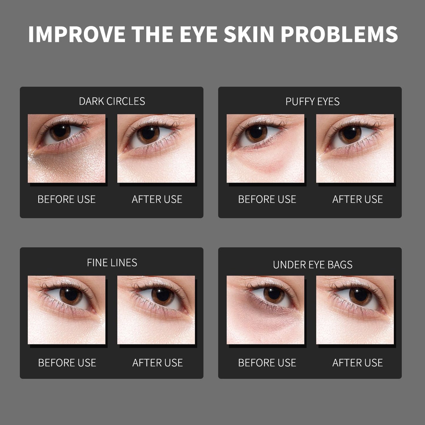 ROUSE Black Pearl Collagen Eye Mask Anti-Wrinkle Under Eye Patches for Puffy Eyes Dark Circles Collagen Eye Gel Pad Moisturizing Brightening Under Eye Mask-60pcs