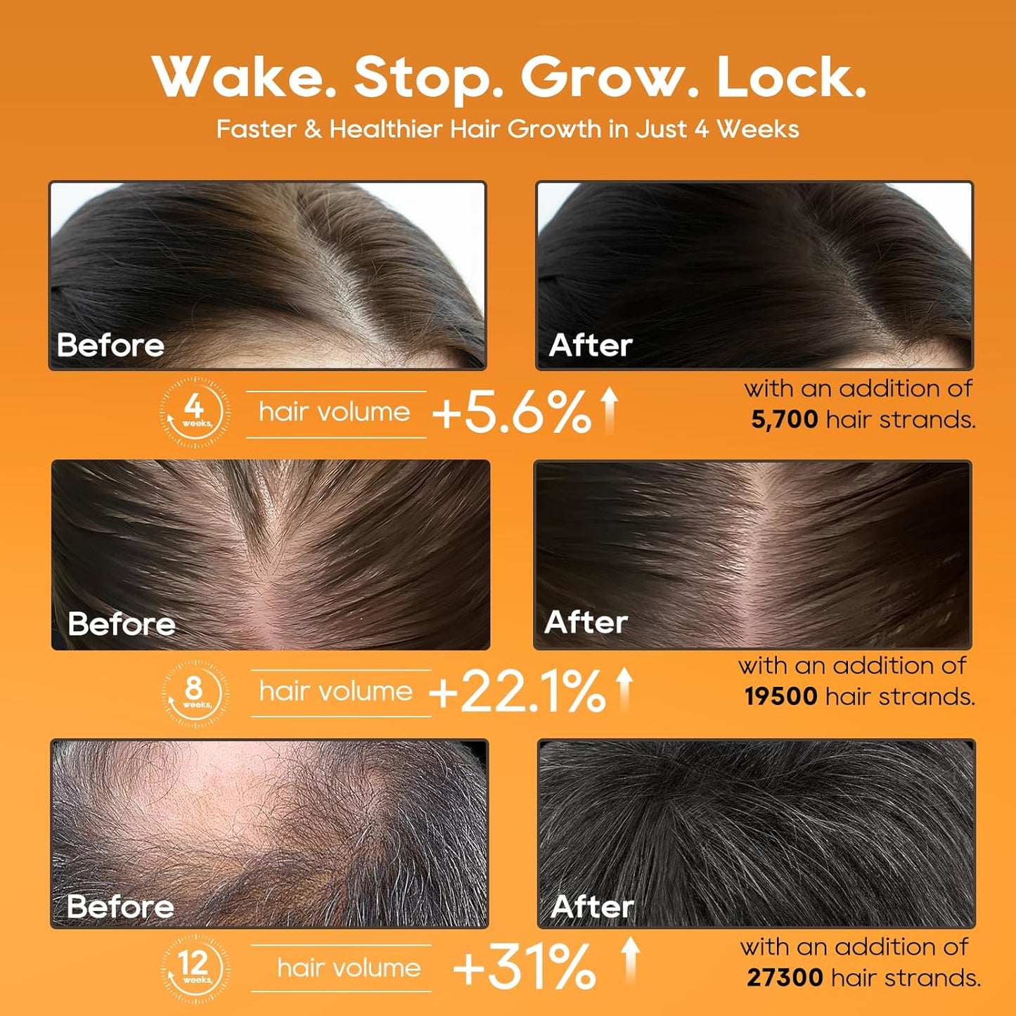 Hair Growth Serum Oil for Women, 100% Veganic Natural Herbal Extracts, Root Revive Visibly Thickening Fuller Hair, Scalp Follicle Stimulator Serum for Hair Loss/Shedding,Thin, Dry & Damaged Treatment