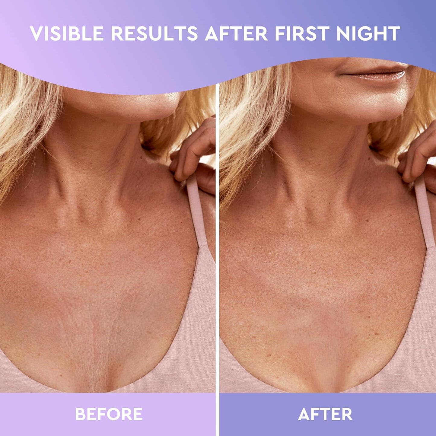 CLEVERFY Silicone Chest Wrinkle Pads Sleeping Reusable (2 Pack T-shape) - Silicone Decollete Anti Wrinkle Chest Pads - Anti Wrinkle Patches for Decollete Wrinkle Prevention