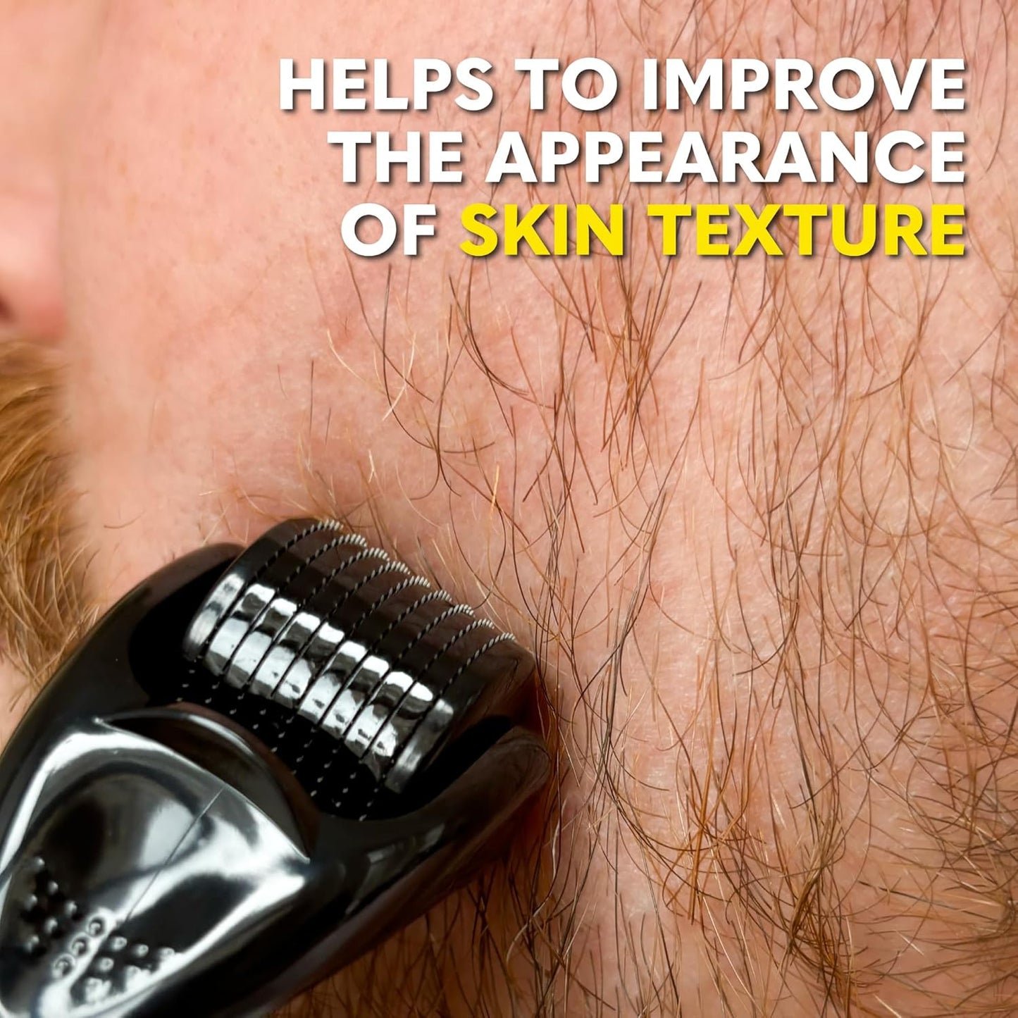 The Beard Club Derma Roller for Face, Body and Scalp - Microneedling for Men and Women with 540 Titanium Microneedles - Beard Roller & Micro Needling Scalp Hair - Black & Yellow