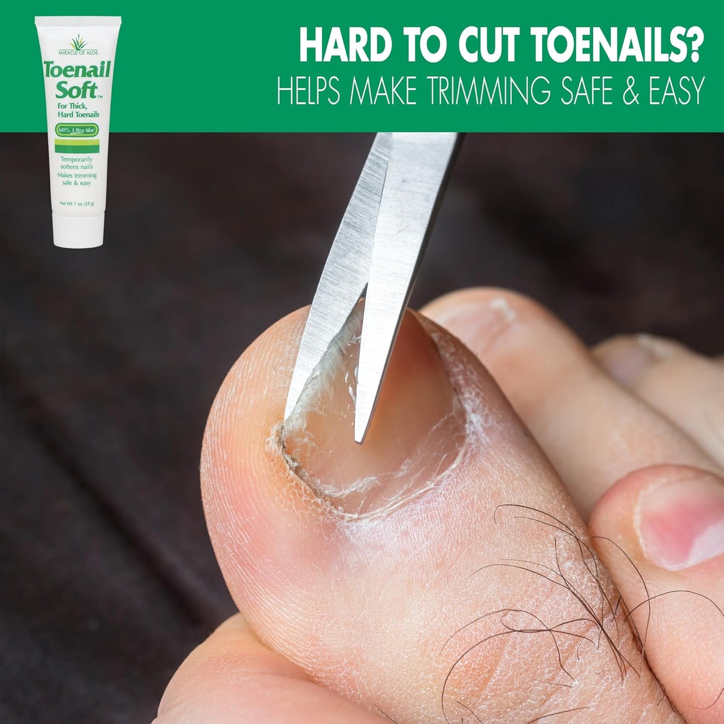 Toenail Softener for Thick Hard Toenails - Safe for Seniors & All Ages - Fast-Acting Toenail Softening Cream - Ingrown Toenail Treatment - Non Greasy Nail Cream Formulated with Natural Aloe Vera, 1 oz