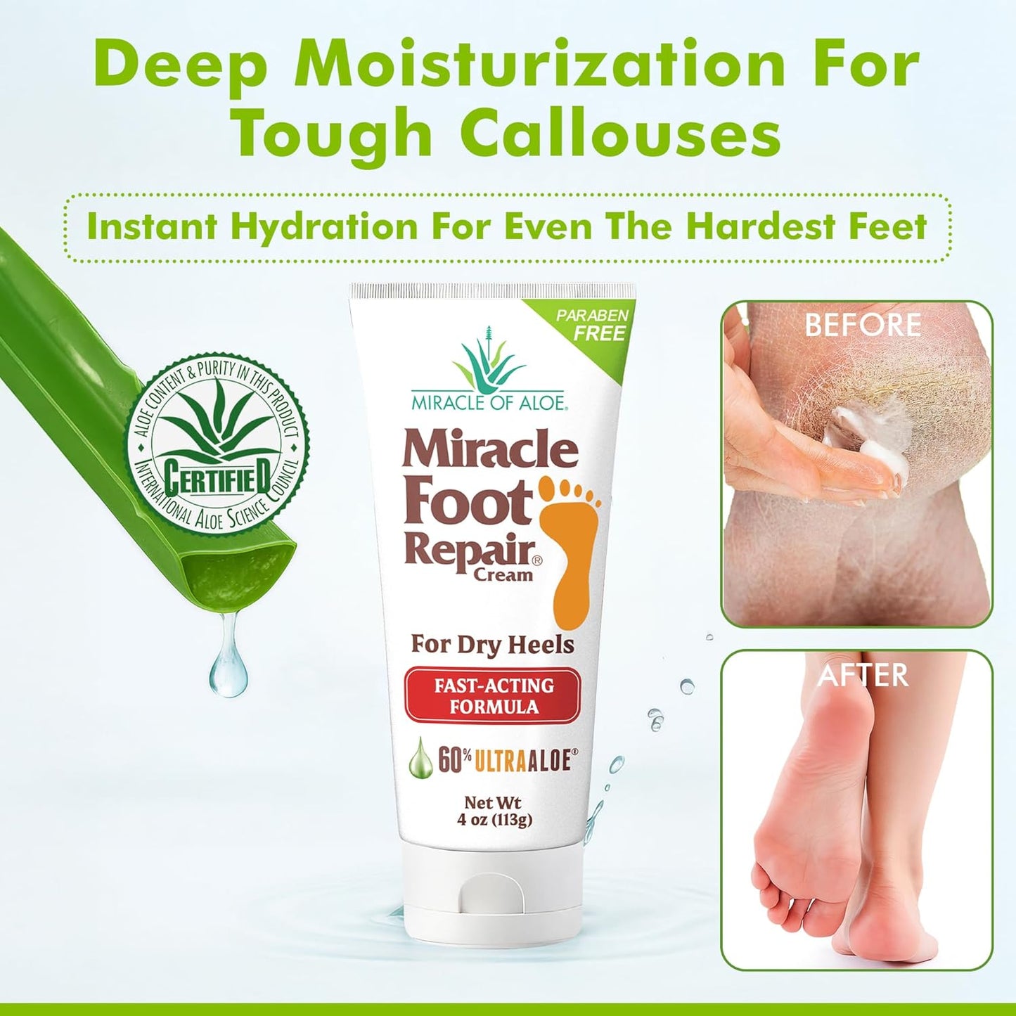 Miracle Foot Repair Cream, 4 oz Repairs Dry Cracked Heels and Feet, Diabetic-Safe, 60% Pure Ultra Aloe Moisturizes, Softens, and Repairs, Relief from Discomfort of Ingrown Toenails (2-Pack)