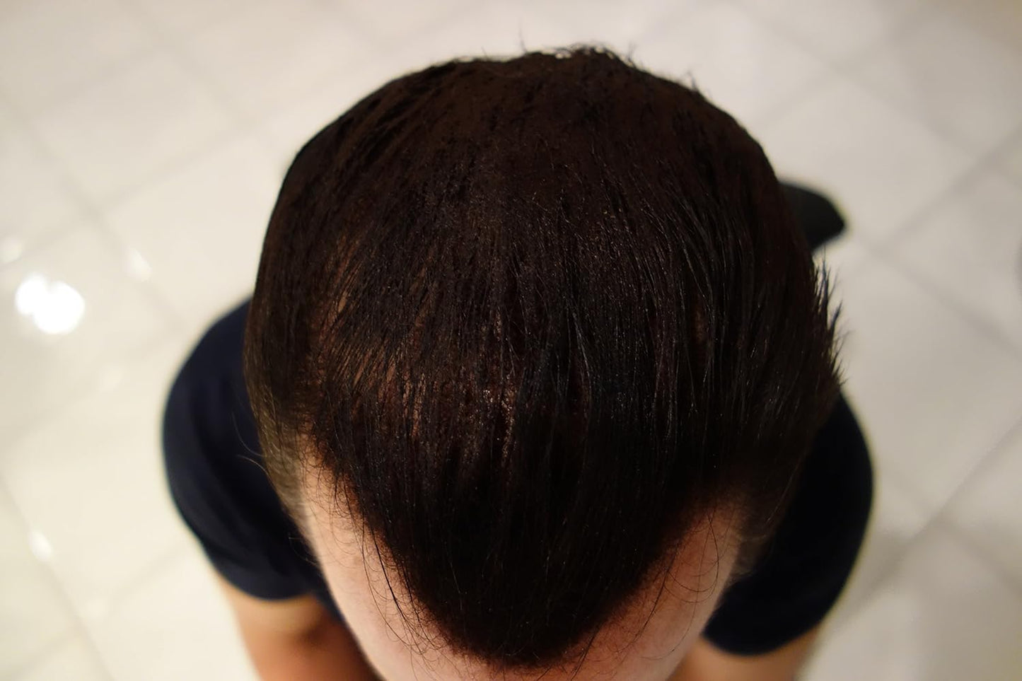 Hair Building Fibers. Dark Chocolate Brown 28g Bottle of Fibers & Finally Hair 120ml 4.1 oz. Fiber Lock Hair Spray.D160 Get Thick Hair Instantly. Baldness be gone. (Dark Chocolate Brown)