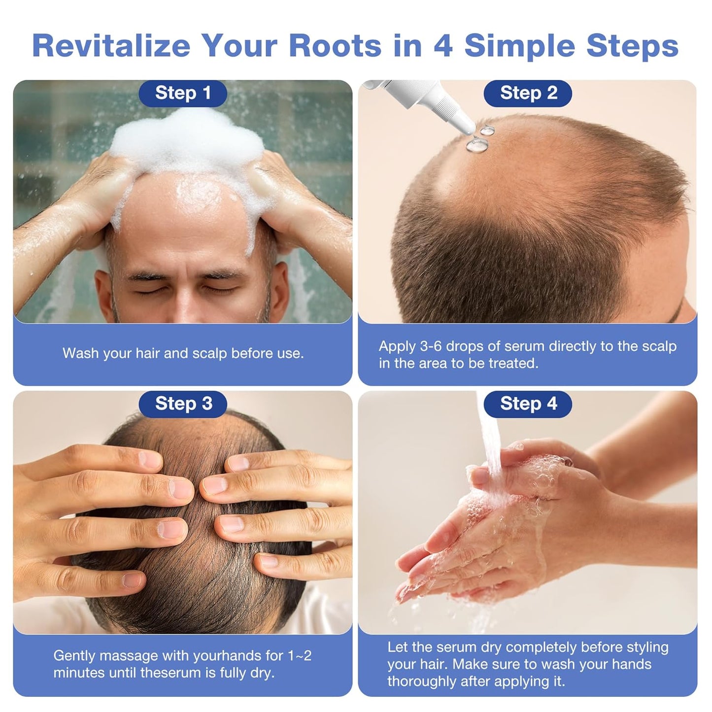 5% Minoxidil for Men Hair Growth Serum - Minoxidil for Women Serum with Biotin for Thicker & Healthier, Topical Minoxidil for Men Restore Fuller Beard